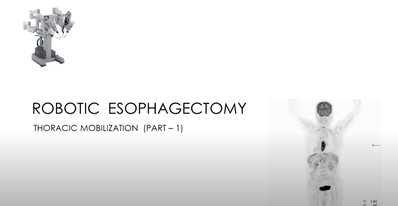 Thoracic mobilization (Part-1)