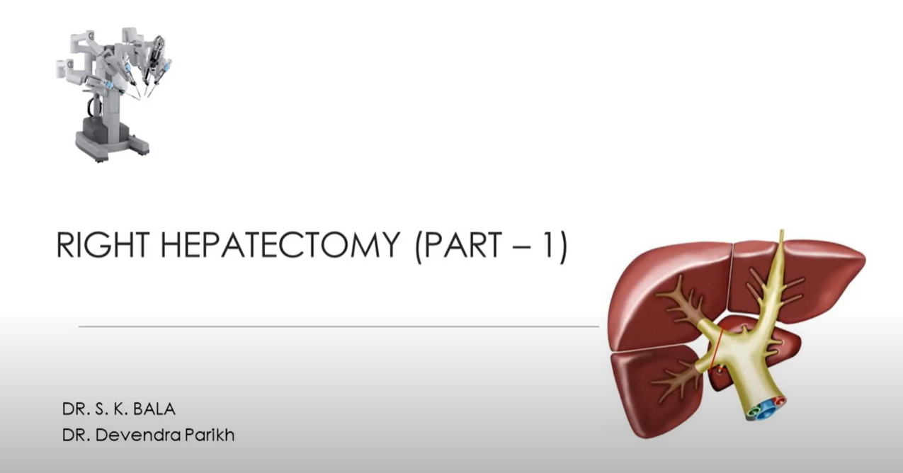 Liver Cancer(Part-1)