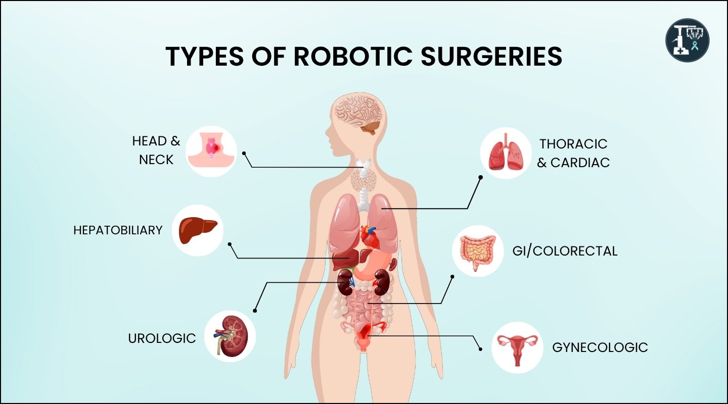 Diagram showing different robotic surgery types mapped to human body areas including urology, GI, and gynecology